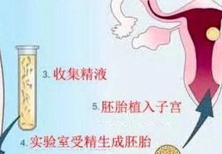 详细解读宿迁市做长方案试管婴儿费用，长方案和短方案成功率有差别吗？