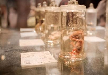 2026年未婚去昆明市妇幼做试管的全部费用要多少？