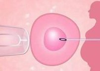 广东试管前10名医院全新发布，附2026三代试管怀孕流程解读