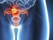 日本第三代试管儿费用你了解多少？