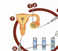 山东大学附属医院生殖医院，哪位主任是试管婴儿领域的佼佼者
